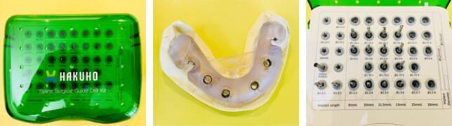 implant_img016